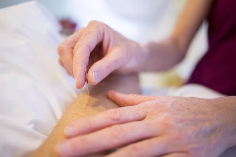 acupuncture-arthritis-treatment-analysis